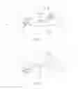 Fig. 02 - Method for operating a hearing device and hearing device