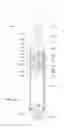 Fig. 04 - Lamp base adapter design for baseless lamps