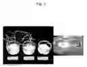 Fig. 06 - Agent for inducing callus and method for inducing callus