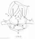 Fig. 02 - CLEAVAGE ENHANCEMENT BRA