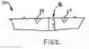 Fig. 03 - CLEAVAGE ENHANCEMENT BRA