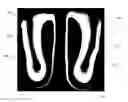 Fig. 01 - ORTHOPEDIC INSOLE