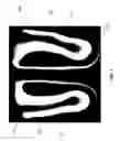 Fig. 02 - ORTHOPEDIC INSOLE