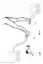 Fig. 05 - ORTHOPEDIC INSOLE