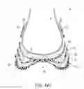 Fig. 10 - Sole structure with alternating spring and damping layers