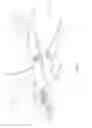 Fig. 17 - Apparatuses and systems for applying glutinous substances