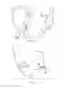 Fig. 08 - Infant chairs
