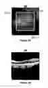 Fig. 04 - System and method for the selection of optical coherence tomography slices