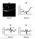 Fig. 05 - System and method for the selection of optical coherence tomography slices