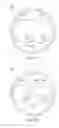 Fig. 05 - STEREO-OPTIC SURGICAL CONTACT LENS