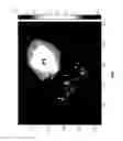 Fig. 16 - Methods and systems for intra-operatively providing anatomical guidance in surgery
