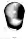 Fig. 09 - Illustrating error in a temperature distribution map