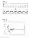 Fig. 09 - Pulse wave signal processor