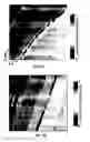 Fig. 03 - Photoacoustic flowmetry systems and methods