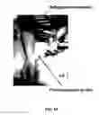 Fig. 07 - Photoacoustic flowmetry systems and methods