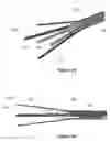 Fig. 17 - Device for interacting with neurological tissue and methods of making and using the same