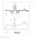 Fig. 22 - Systems and methods for providing cardiac electrophysiological markers