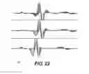Fig. 23 - Systems and methods for providing cardiac electrophysiological markers