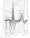 Fig. 28 - Systems and methods for providing cardiac electrophysiological markers