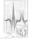Fig. 34 - Systems and methods for providing cardiac electrophysiological markers