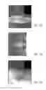 Fig. 02 - MR SPECTROSCOPY SYSTEM AND METHOD FOR DIAGNOSING PAINFUL AND NON-PAINFUL INTERVERTEBRAL DISCS