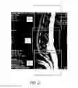 Fig. 03 - MR SPECTROSCOPY SYSTEM AND METHOD FOR DIAGNOSING PAINFUL AND NON-PAINFUL INTERVERTEBRAL DISCS