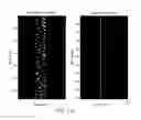 Fig. 12 - MR SPECTROSCOPY SYSTEM AND METHOD FOR DIAGNOSING PAINFUL AND NON-PAINFUL INTERVERTEBRAL DISCS