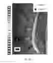 Fig. 31 - MR SPECTROSCOPY SYSTEM AND METHOD FOR DIAGNOSING PAINFUL AND NON-PAINFUL INTERVERTEBRAL DISCS