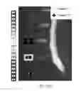 Fig. 32 - MR SPECTROSCOPY SYSTEM AND METHOD FOR DIAGNOSING PAINFUL AND NON-PAINFUL INTERVERTEBRAL DISCS