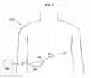 Fig. 08 - Voice control system for an implant