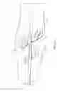 Fig. 07 - VEIN ACCESS NEEDLE GUIDE ASSEMBLY AND METHODS OF USE FOR VENIPUNCTURE AND VEIN STABILIZATION