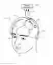 Fig. 01 - Method for assessment of cerebrovascular regulation