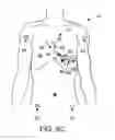 Fig. 06 - Method and system of directing positioning of ECG electrodes