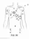 Fig. 07 - Method and system of directing positioning of ECG electrodes
