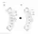 Fig. 05 - Curved movable beam stop array and CBCT comprising thereof