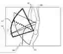 Fig. 01 - Guidance device for a tee probe