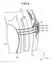 Fig. 06 - Gantry
