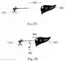 Fig. 06 - Device and method for assisting laparoscopic surgery—rule based approach