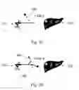 Fig. 07 - Device and method for assisting laparoscopic surgery—rule based approach