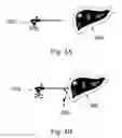 Fig. 08 - Device and method for assisting laparoscopic surgery—rule based approach