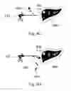 Fig. 09 - Device and method for assisting laparoscopic surgery—rule based approach
