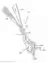 Fig. 01 - Intervertebral prosthesis placement instrument