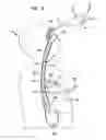 Fig. 06 - Systems, devices, components and methods for displacing and repositioning the esophagus away from the heart during atrial ablation surgical procedures