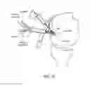 Fig. 09 - Surgical constructs for tissue repair