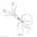 Fig. 16 - Surgical constructs for tissue repair
