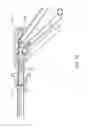 Fig. 80 - Suturing needles