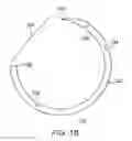 Fig. 22 - Apparatus and method for minimally invasive suturing