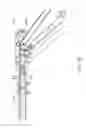 Fig. 80 - Apparatus and method for minimally invasive suturing