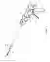 Fig. 02 - Surgical staple actuating sled with actuation stroke having minimized distance relative to distal staple