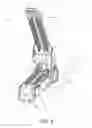 Fig. 05 - End effector for surgical stapler with varying curve and taper